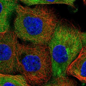 Anti-NCEH1 antibody produced in rabbit 