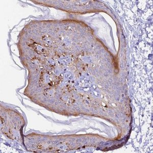 Anti-NCK2 antibody produced in rabbit HPA031004-100UL