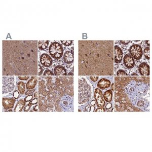 Anti-NDUFA8 antibody produced in rabbit HPA041510-100UL