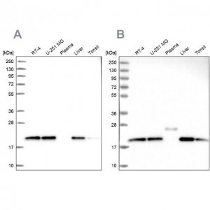 Anti-NDUFA8 antibody produced in rabbit HPA041510-100UL