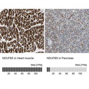 Anti-NDUFB5 antibody produced in rabbit 