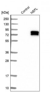 Anti-NEFL antibody produced in rabbit 