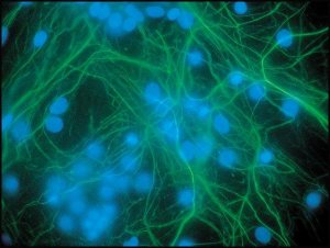 Anti-Neurofilament 200 antibody produced in rabbit 