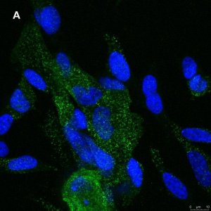Anti-NMDAR2A Antibody, clone A12W, ZooMAb� Rabbit Monoclonal 