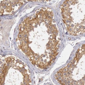 Anti-NMT2 antibody produced in rabbit 