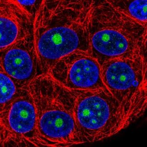 Anti-NOP16 antibody produced in rabbit 