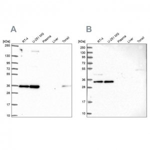 Anti-NOSIP antibody produced in rabbit 