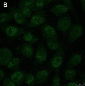 Anti-Notch1 Antibody, clone 1A32 ZooMAb� Rabbit Monoclonal 