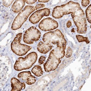 Anti-NOXA1 antibody produced in rabbit 