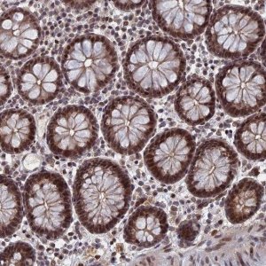 Anti-NR2C2AP antibody produced in rabbit 
