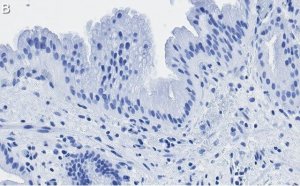 Anti-Nrf2 Antibody, clone 5B20 ZooMAb� Rabbit Monoclonal 