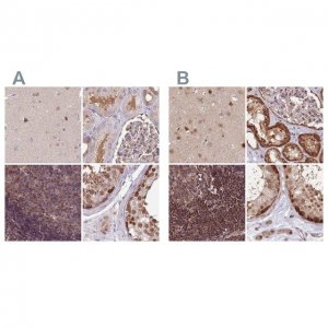 Anti-NSFL1C antibody produced in rabbit 