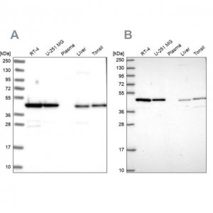 Anti-NSFL1C antibody produced in rabbit 