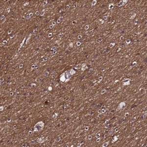 Anti-NSMF antibody produced in rabbit 