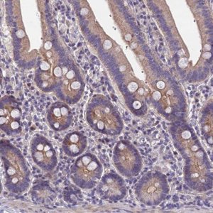 Anti-NT5M antibody produced in rabbit 