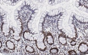 Anti-Nucleolin Antibody, clone 5D13 ZooMAb� Rabbit Monoclonal 