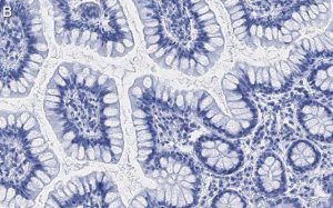 Anti-Nucleolin Antibody, clone 5D13 ZooMAb� Rabbit Monoclonal 