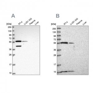 Anti-NUP50 antibody produced in rabbit 