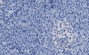 Anti-O-GlcNAc Transferase Antibody, clone 1O19 ZooMAb� Rabbit Monoclonal 