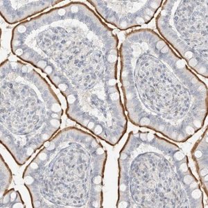 Anti-OSBPL7 antibody produced in rabbit 