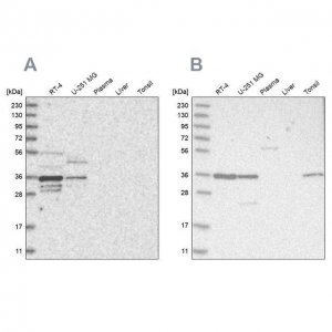 Anti-OTUD6B antibody produced in rabbit HPA024046-100UL