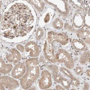 Anti-OTUD6B antibody produced in rabbit HPA024046-100UL