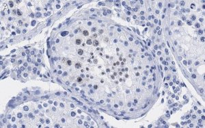 Anti-p14ARF Antibody, clone 4F19 ZooMAb� Rabbit Monoclonal 