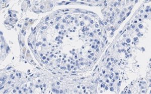 Anti-p14ARF Antibody, clone 4F19 ZooMAb� Rabbit Monoclonal 