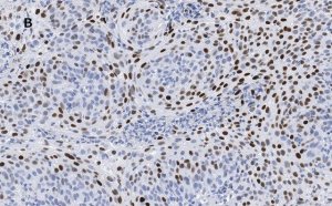Anti-p21 Antibody, clone 5G7, ZooMAb� Rabbit Monoclonal 