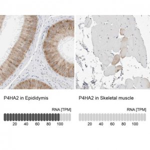Anti-P4HA2 antibody produced in rabbit 