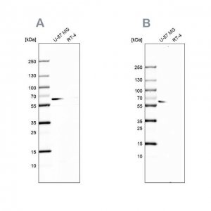 Anti-P4HA2 antibody produced in rabbit 