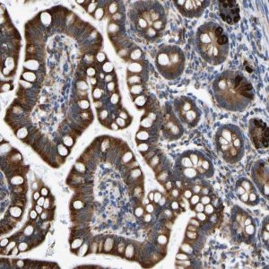 Anti-P4HB antibody produced in rabbit 