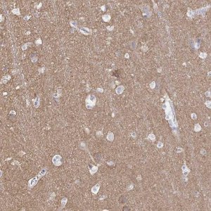 Anti-PACSIN1 antibody produced in rabbit HPA055491-100UL