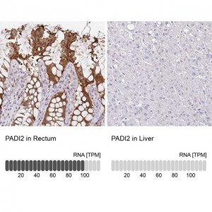 Anti-PADI2 antibody produced in rabbit 