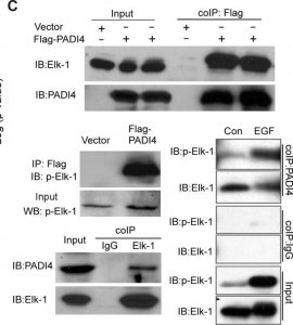 Anti-PADI4 (N-terminal) antibody produced in rabbit P4749-200UL