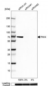 Anti-PAK4 antibody produced in rabbit 