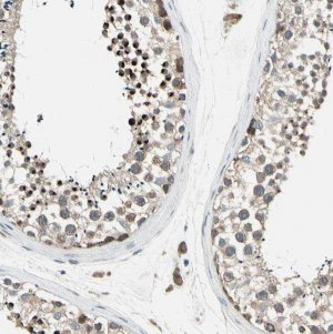 Anti-PANK2 antibody produced in rabbit HPA008440-100UL