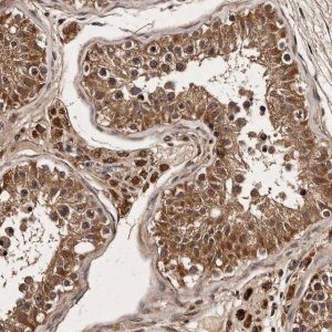 Anti-PARS2 antibody produced in rabbit HPA028314-100UL