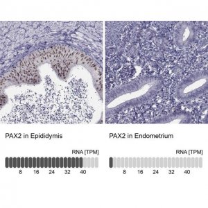 Anti-PAX2 antibody produced in rabbit 