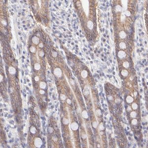 Anti-PBDC1 antibody produced in rabbit HPA003155-100UL