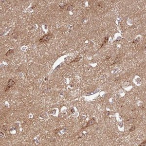 Anti-PCDH1 antibody produced in rabbit HPA047720-100UL
