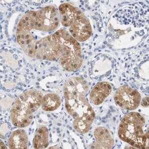Anti-PCK1 antibody produced in rabbit 