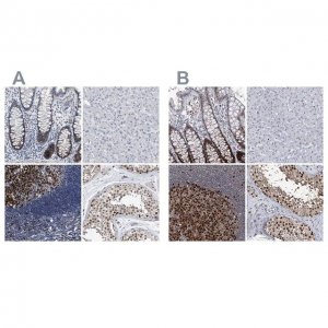 Anti-PCNA antibody produced in rabbit HPA030521-100UL