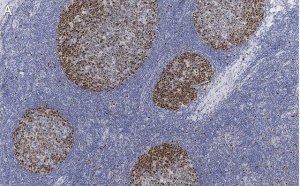 Anti-PCNA Antibody, clone 3B22 ZooMAb� Rabbit Monoclonal 