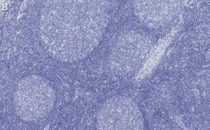 Anti-PCNA Antibody, clone 3B22 ZooMAb� Rabbit Monoclonal 