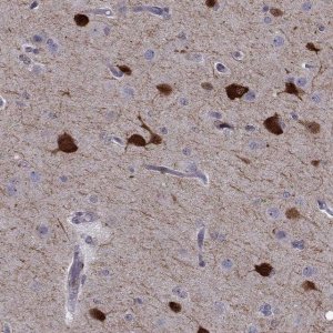 Anti-PCP4L1 antibody produced in rabbit 