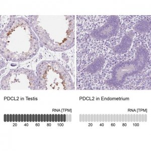 Anti-PDCL2 antibody produced in rabbit 