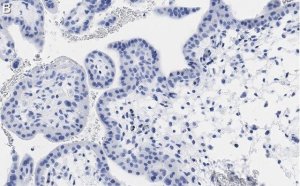 Anti-PDE4B Antibody, clone 1E9 ZooMAb� Rabbit Monoclonal 