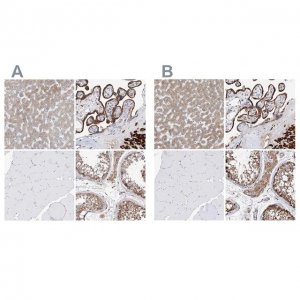 Anti-PDIA5 antibody produced in rabbit 