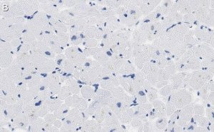 Anti-PDK4 Antibody, clone 2H5 ZooMAb� Rabbit Monoclonal 